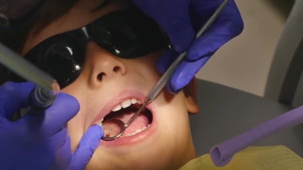 Primer plano niño pequeño durante el procedimiento de tratamiento de perforación de dientes en el consultorio de la clínica dentista — Vídeos de Stock