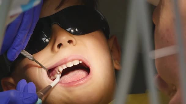 Nahaufnahme kleines Kind während der Behandlung des Zahnbohrens in der Zahnarztpraxis