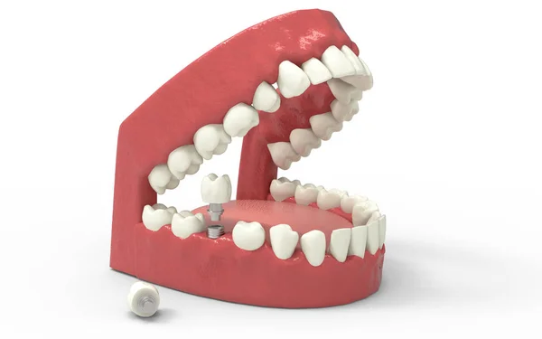 Zahn 3D Rendering — Stockfoto