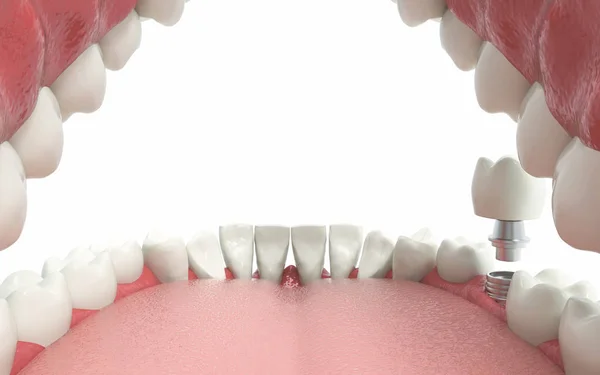 Tooth 3D illustration. — Stock Photo, Image