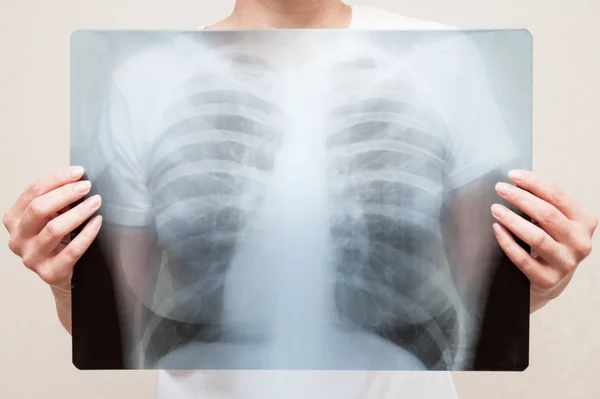 Bir kadın bir x-ray görüntü kendi tutuyor