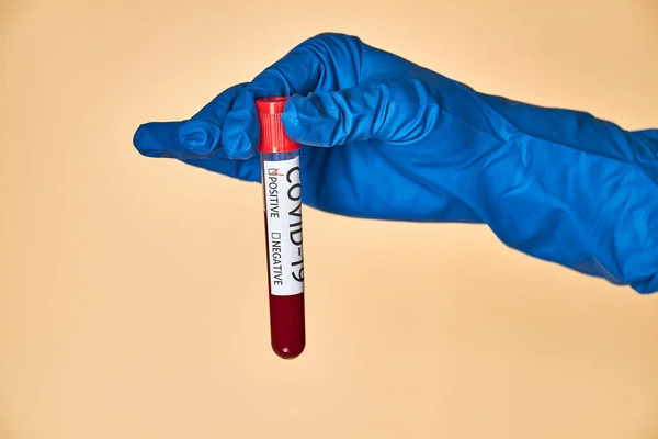Koncepcyjne Zdjęcie Ręka Posiada Próbki Krwi Obecność Probówki Koronawirusowej Zawierającej — Zdjęcie stockowe