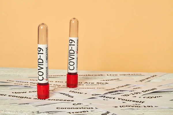 Conceptual photo. Blood test samples for presence of coronavirus. Tubes containing a blood samples that has tested positive and negative for coronavirus.