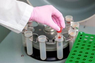 Doktor klinikteki santrifüj makinesine koronavirüs analizi için kan tüpü koydu..