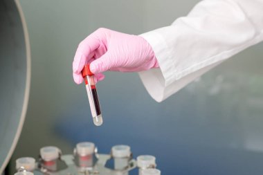 Doktorun eldiveni ve santrifüj arka planında kan testi tüpü..