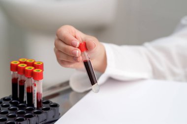 Doktor masadaki tepsiden kan örneği tüpleri alıyor..