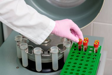 El, tıbbi klinikte test tüpünden santrifüj makinesine kan tüpü alır. Coronavirüs analizi yapılır..