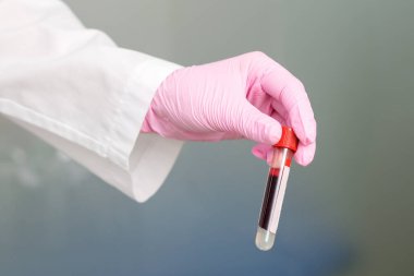 Hemşirenin eli kanla dolu test tüpünü tutarken yakın durun..