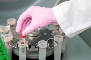 Doktor klinikteki santrifüj makinesine koronavirüs analizi için kan tüpü koydu..