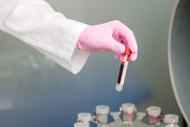 Hemşire laboratuarda kanla test tüpü tutuyor..