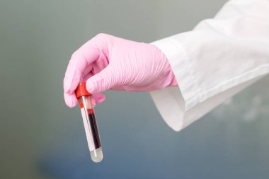 Laboratuvarda kan dolu test tüpü tutan hemşire..