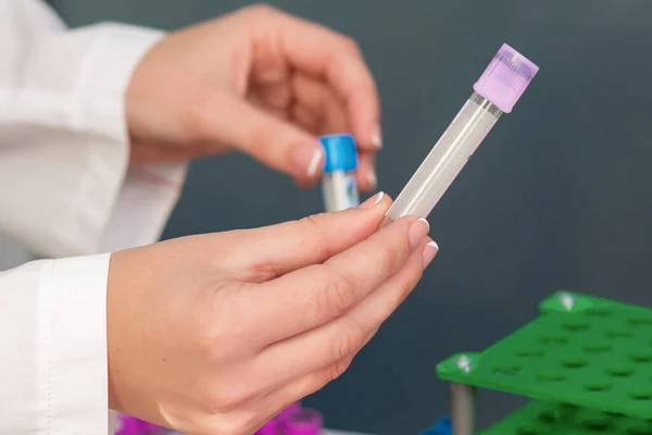 Doctor Holds Blood Sample Tubes His Hands Lab — Stock Photo, Image