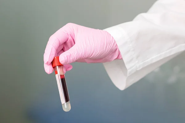 Enfermeira Segurando Tubo Teste Com Sangue Close Laboratório — Fotografia de Stock