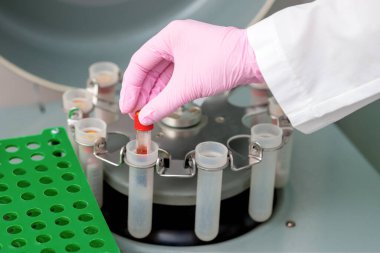 Doktor klinikteki santrifüj makinesine koronavirüs analizi için kan tüpü koydu..