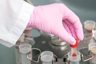 Doktor klinikteki santrifüj makinesine koronavirüs analizi için kan tüpü koydu..