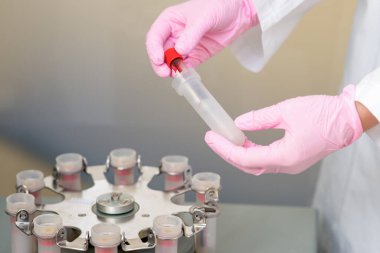 Coronavirüs analizi yapılırken hemşirenin ellerinde kan tüpü test edildi..