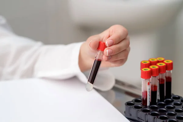 Doutor Leva Tubo Amostra Sangue Bandeja Mesa — Fotografia de Stock