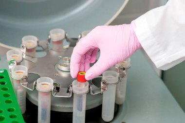 Erkek el koruyucu eldiven takarak test tüpünü santrifüj makinesine yerleştiriyor..