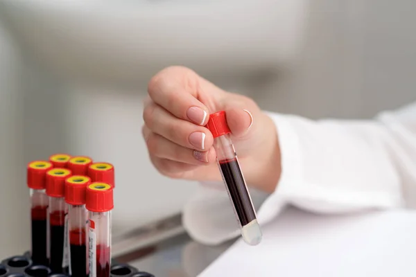 Médico Mão Segurando Tubo Teste Com Amostra Sangue Perto — Fotografia de Stock