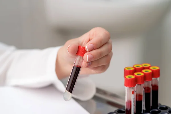 Doctor Hand Taking Test Tube Blood Sample Tray Table — Stock Photo, Image