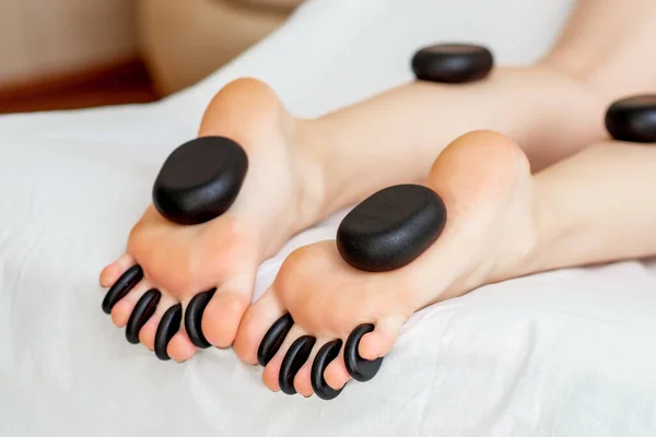 Piedras Masaje Caliente Los Pies Mujer Mientras Que Masaje Piernas — Foto de Stock