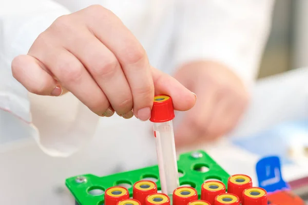 Doctor Hand Taking Test Tube Tray Table Close — Stock Photo, Image