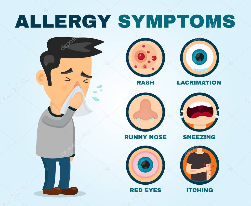 Síntomas de alergia problema infografía. Vector 2023