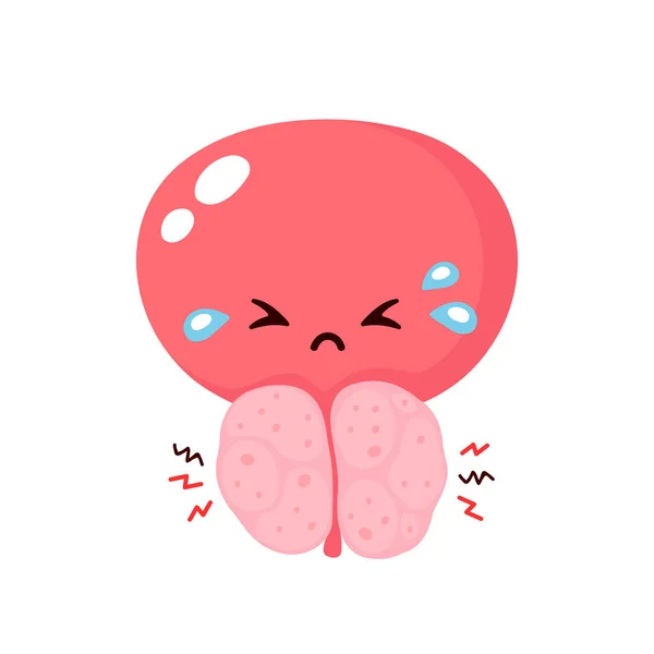 Benign prostatic hyperplasia. Cute  bladder — 스톡 벡터