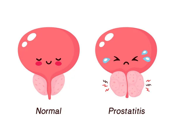 diplococcci prostatitis)