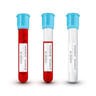 Virüs Covid19 için laboratuvar kan testi. Gerçekçi 3 boyutlu cam test tüpünü hazırlayın. Roman Coronavirus 2019-nCoV tek iplikli RNA virüsü. Pozitif, negatif ve boş. vektör illüstrasyonu.