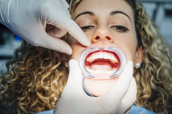 Mujer joven recibiendo aparatos ortopédicos puestos en los dientes —  Fotos de Stock