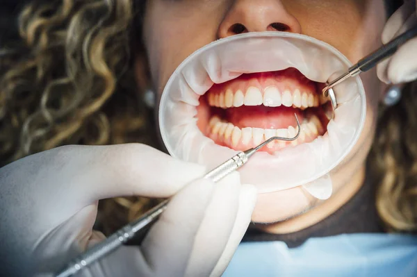 Dentista trabajando en su consultorio con un paciente . —  Fotos de Stock