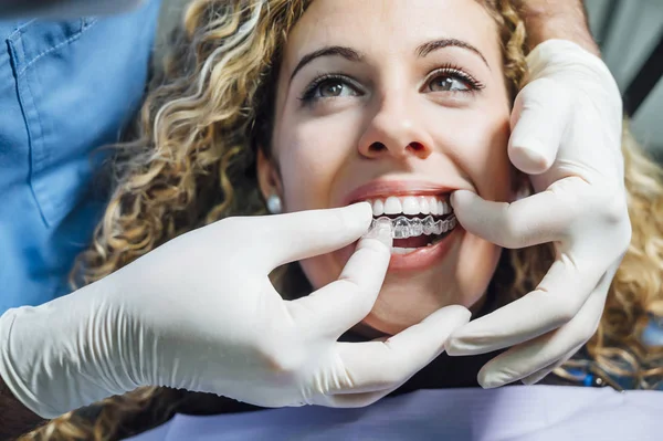 Médico colocando um aligner dental claro para a mulher paciente — Fotografia de Stock