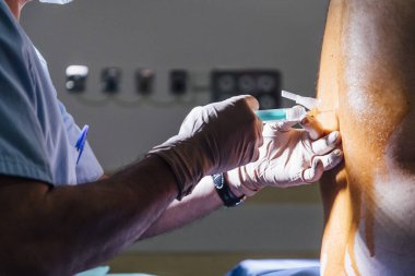 Doktor iğneyi hazırlar epidural epidural