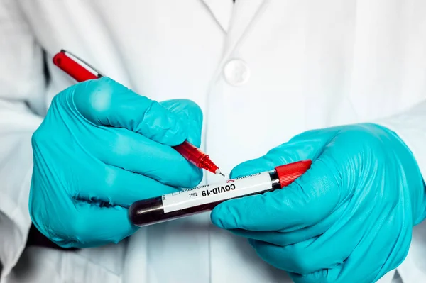 Perawat Menulis Hasil Tes Darah Covid — Stok Foto