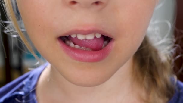 Niña con tambaleante primer diente temporal de leche — Vídeo de stock