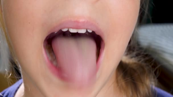 Söt liten flicka barn visar halsen med tunga — Stockvideo