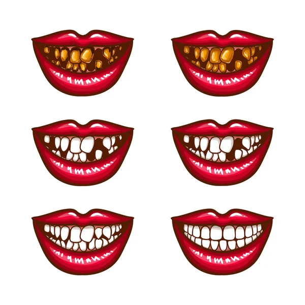Una collezione di icone pop art di labbra rosse femminili sorridenti, con denti mancanti, con denti rovinati — Vettoriale Stock