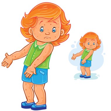 Küçük kız bir döküntü cilt, çiçek hastalığı, su çiçeği, uyuz, Anti ile vektör