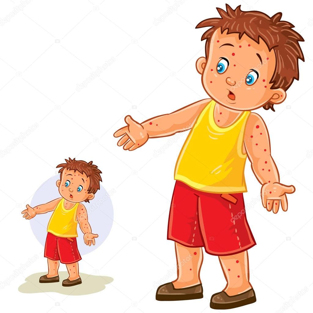 Vector little boy with a rash on his hands and legs