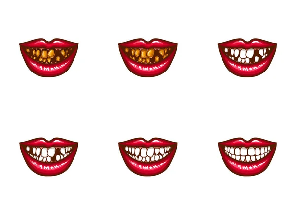 Clipart της γυναικείας στόματα με οδοντικά προβλήματα — Διανυσματικό Αρχείο