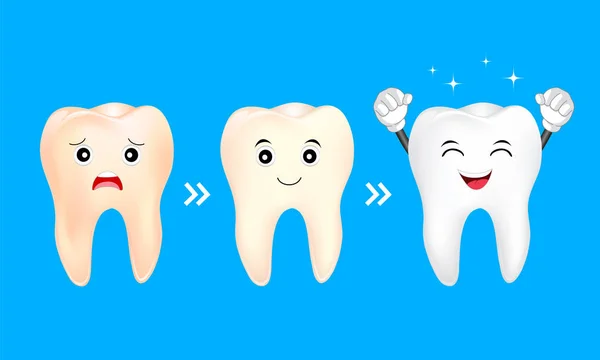 Sbiancamento del carattere dei denti . — Vettoriale Stock