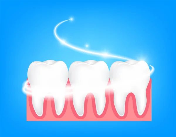 Branqueamento do dente humano. Limpeza profunda, processo de limpeza do dente . —  Vetores de Stock