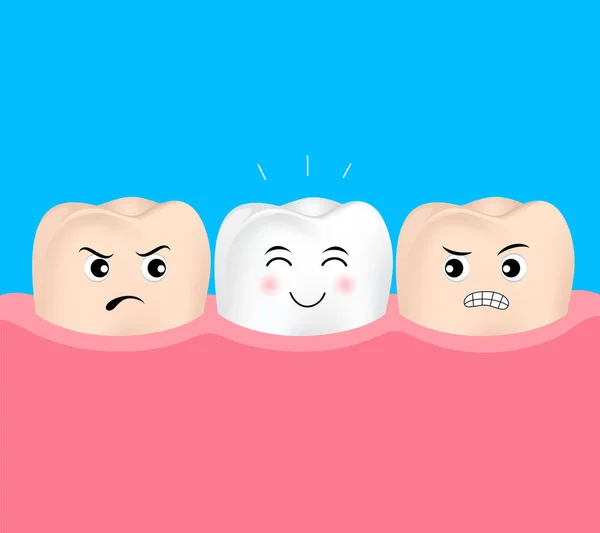 Folheados dentários num dente humano. Antes e depois . — Vetor de Stock