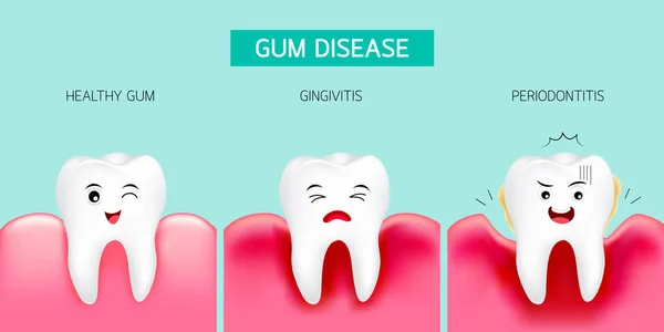 Passo da doença das gengivas. Dente saudável e gengivite . —  Vetores de Stock