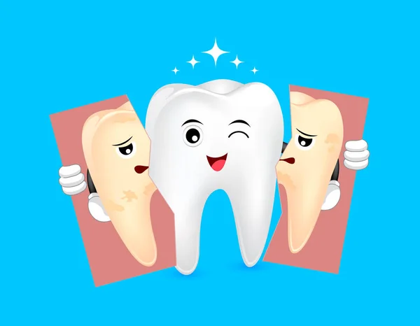 Desenhos animados bonito branqueamento dente segurando lágrima de dente não saudável . —  Vetores de Stock