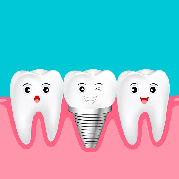 Dos dientes sanos y diente de implante entre . — Archivo Imágenes Vectoriales
