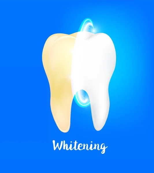 Nettoyage dent sale sur fond bleu, processus de nettoyage de la dent . — Image vectorielle
