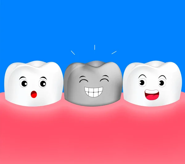 銀歯と歯で健康的な漫画。金属のクラウン. — ストックベクタ