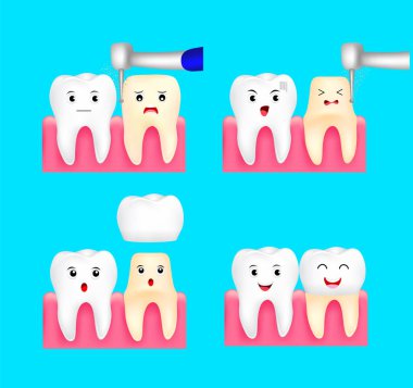 Diş crown yükleme işlemi. Sevimli çizgi diş karakter. Diş Bakımı kavramı. İllüstrasyon izole mavi arka plan üzerinde.